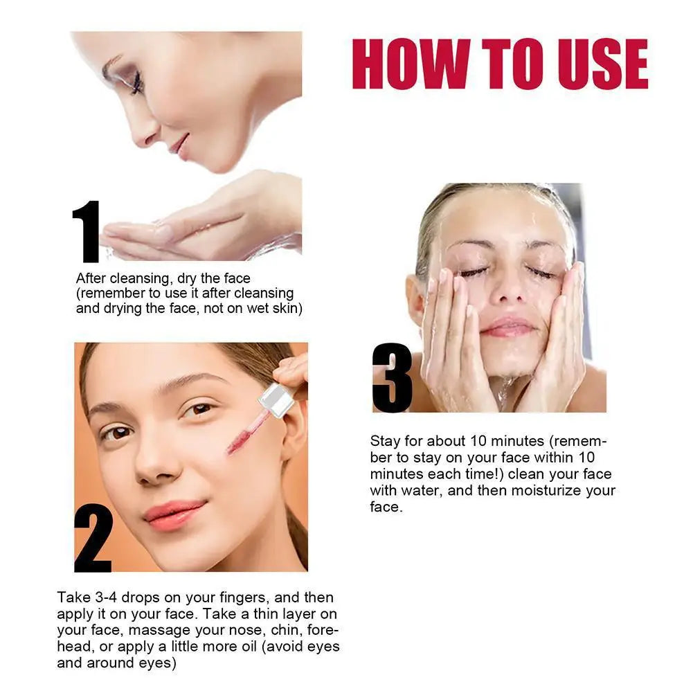 30ml Salicylic Acid Shrink Pores Serum Moisturizing Nourishing Smooth skin Essence reduce Acne Blackhead Skin care for Women