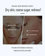 Facial Redness Repair Cream Improve Sensitive Skin Dryness Moisturizer Hydrating Sooth Lotion Removal Rosacea Korean Cosmetics
