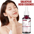 30ml Salicylic Acid Shrink Pores Serum Moisturizing Nourishing Smooth skin Essence reduce Acne Blackhead Skin care for Women