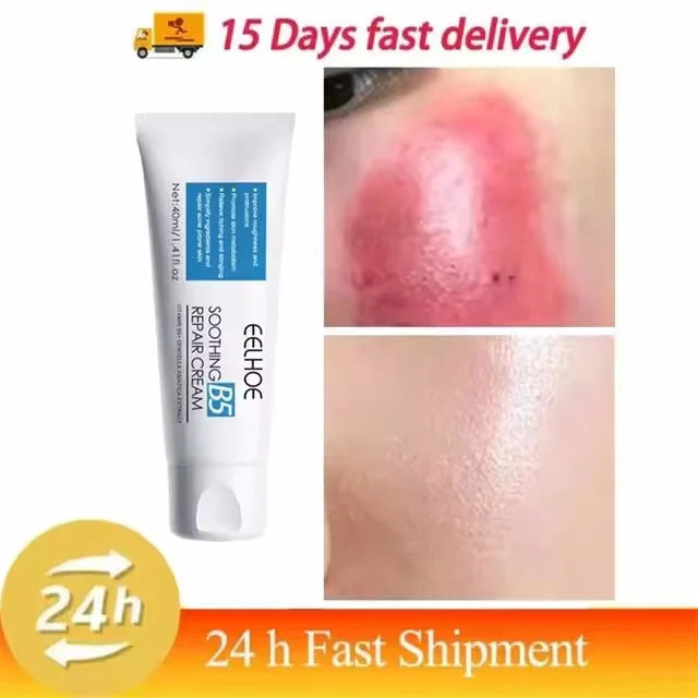 Facial Redness Repair Cream Improve Sensitive Skin Dryness Moisturizer Hydrating Sooth Lotion Removal Rosacea Korean Cosmetics