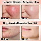 Facial Redness Repair Cream Improve Sensitive Skin Dryness Moisturizer Hydrating Sooth Lotion Removal Rosacea Korean Cosmetics