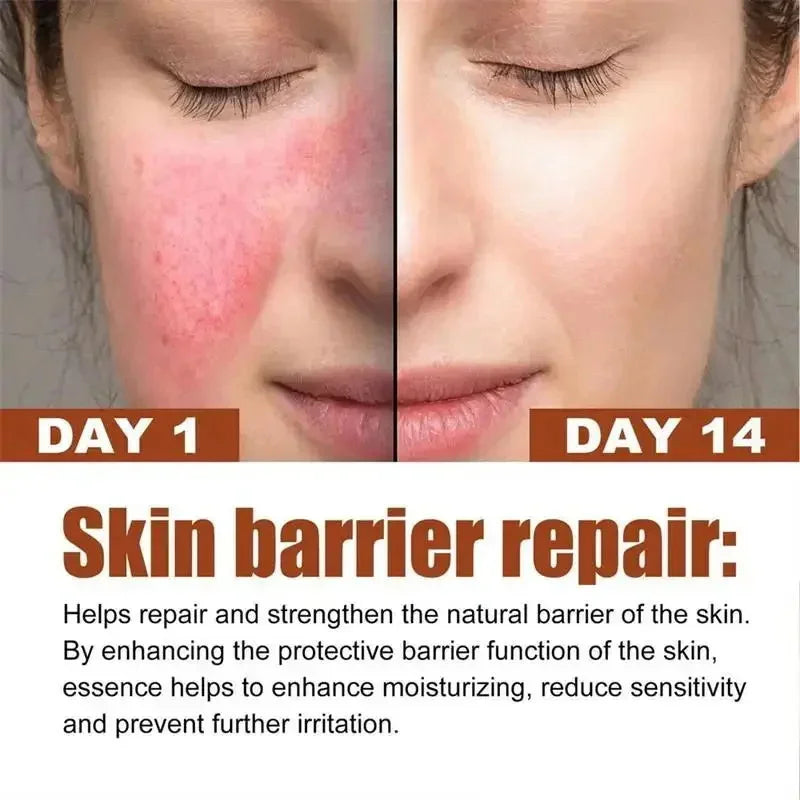 Facial Redness Repair Cream Improve Sensitive Skin Dryness Moisturizer Hydrating Sooth Lotion Removal Rosacea Korean Cosmetics
