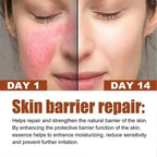 Facial Redness Repair Cream Improve Sensitive Skin Dryness Moisturizer Hydrating Sooth Lotion Removal Rosacea Korean Cosmetics