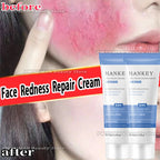 Facial Redness Repair Cream Improve Sensitive Skin Dryness Moisturizer Hydrating Sooth Lotion Removal Rosacea Korean Cosmetics