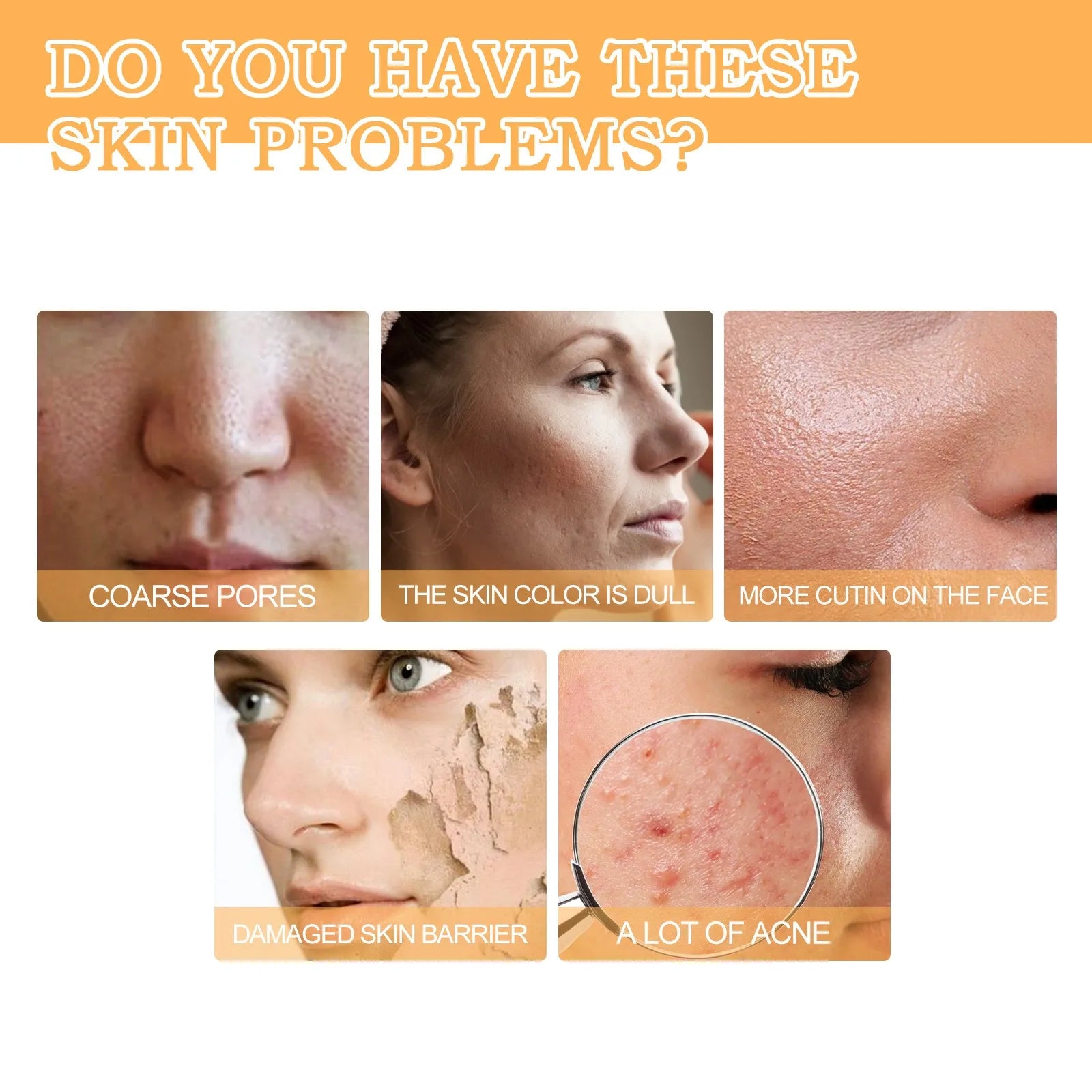 Glycolic Acid 7% Toning Solution Ordinary Acne Remover Lifting Firming Wrinkles Glowing Facial Skin Care Glycolic Acid Toner